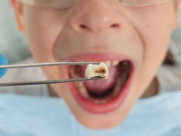 Best Broken Tooth Emergency  in Girard, IL